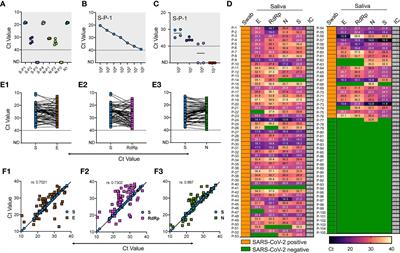 A Saliva-Based RNA Extraction-Free Workflow Integrated With Cas13a for SARS-CoV-2 Detection